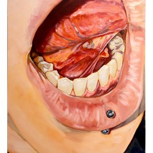 Is there a burn? (Shannon Sandwell)
